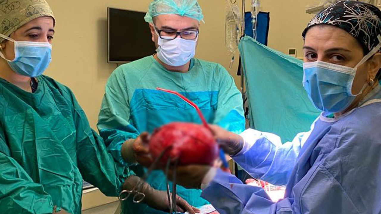 Bitlis'te karın ağrısıyla başvuran kadının rahminden karpuz büyüklüğünde kitle çıkarıldı