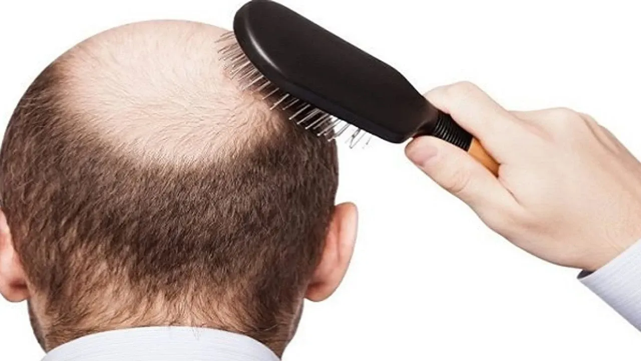 Kellik tarih oluyor! 20 günde sonuç veren tedavinin klinik denemeleri başlıyor