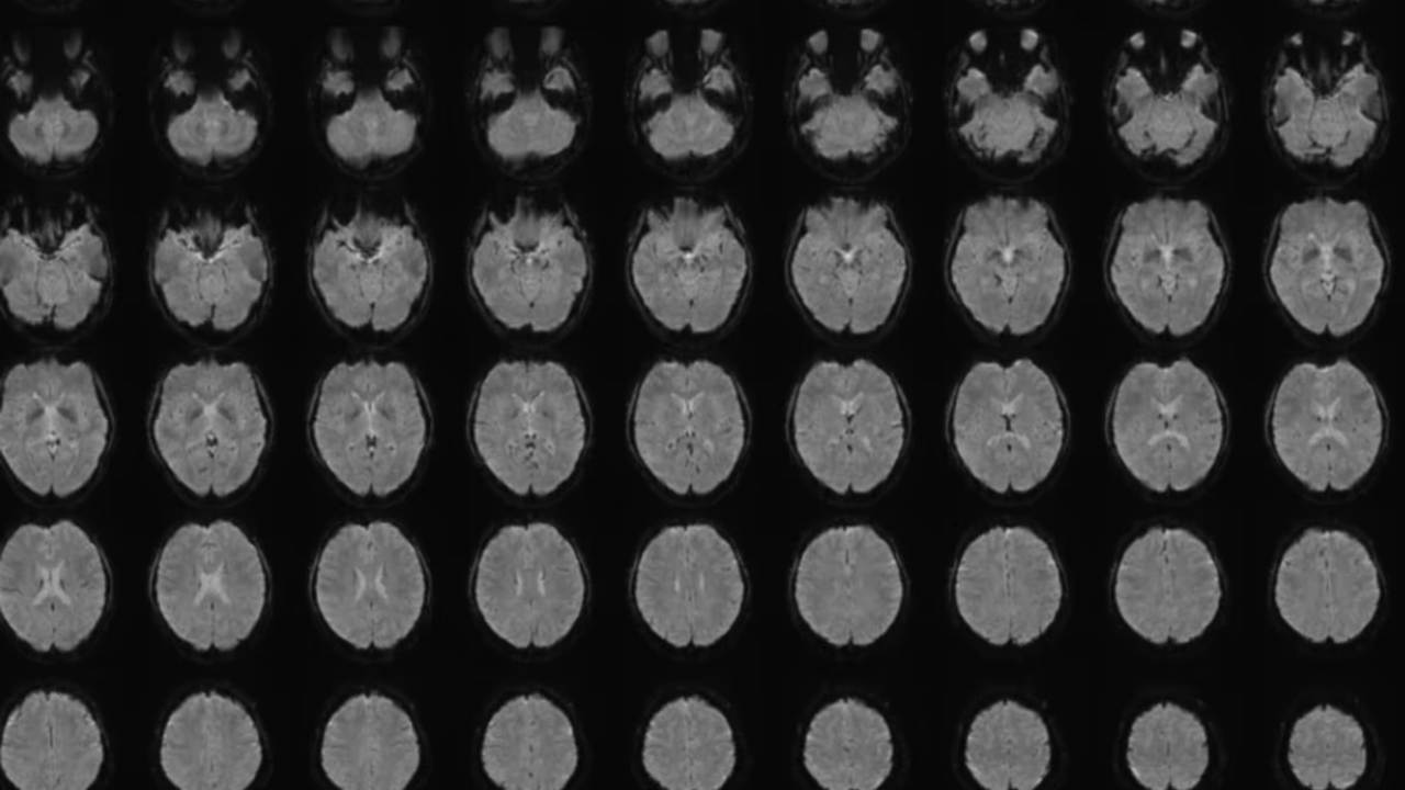 Zihin okuma gerçek oldu: Düşünceler artık metne dönüştürülüyor