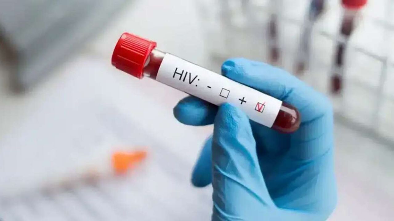 DSÖ açıkladı: AIDS vakaları bir milyonu aştı!