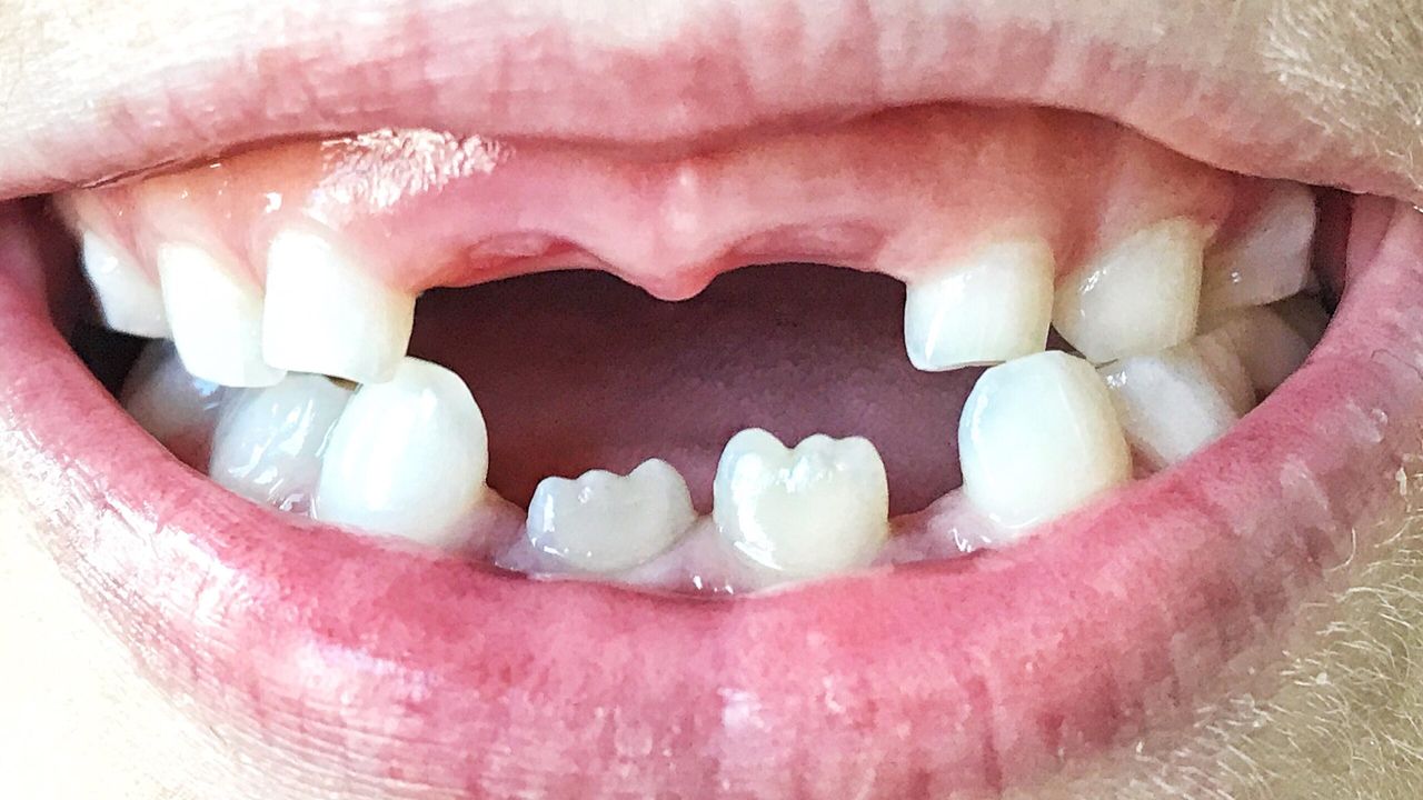 Dişleriniz erken ölüp ölmeyeceğinizi haber veriyor