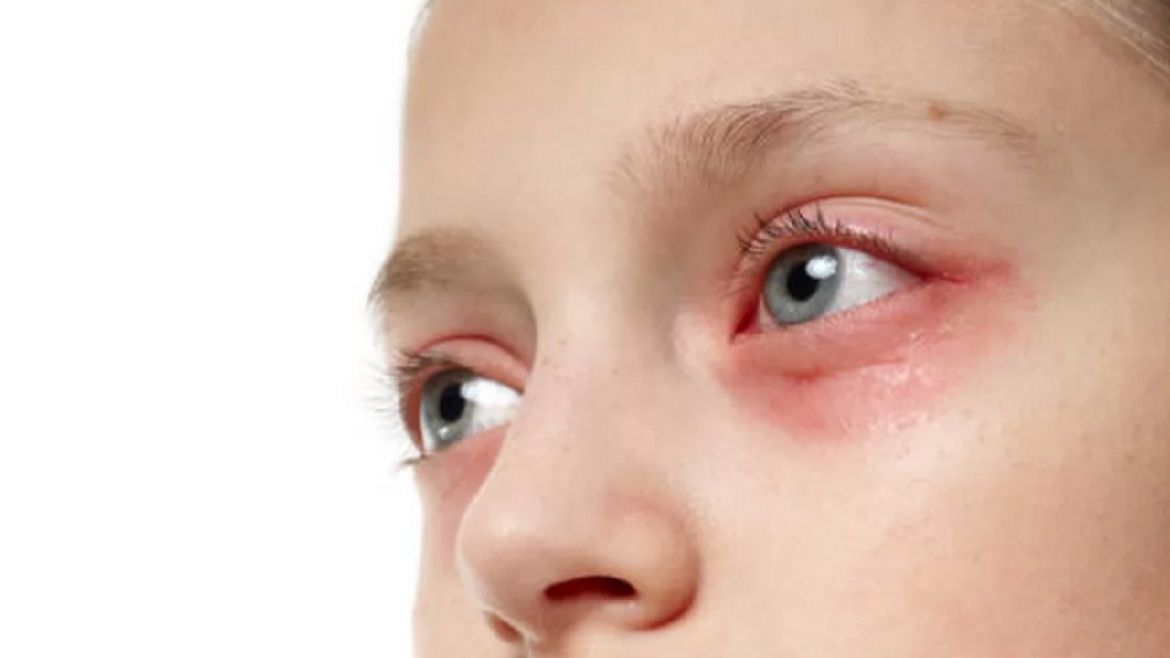 Op. Dr. Diri: Çocuklarda göz enfeksiyonları görme gelişimini olumsuz etkileyebilir