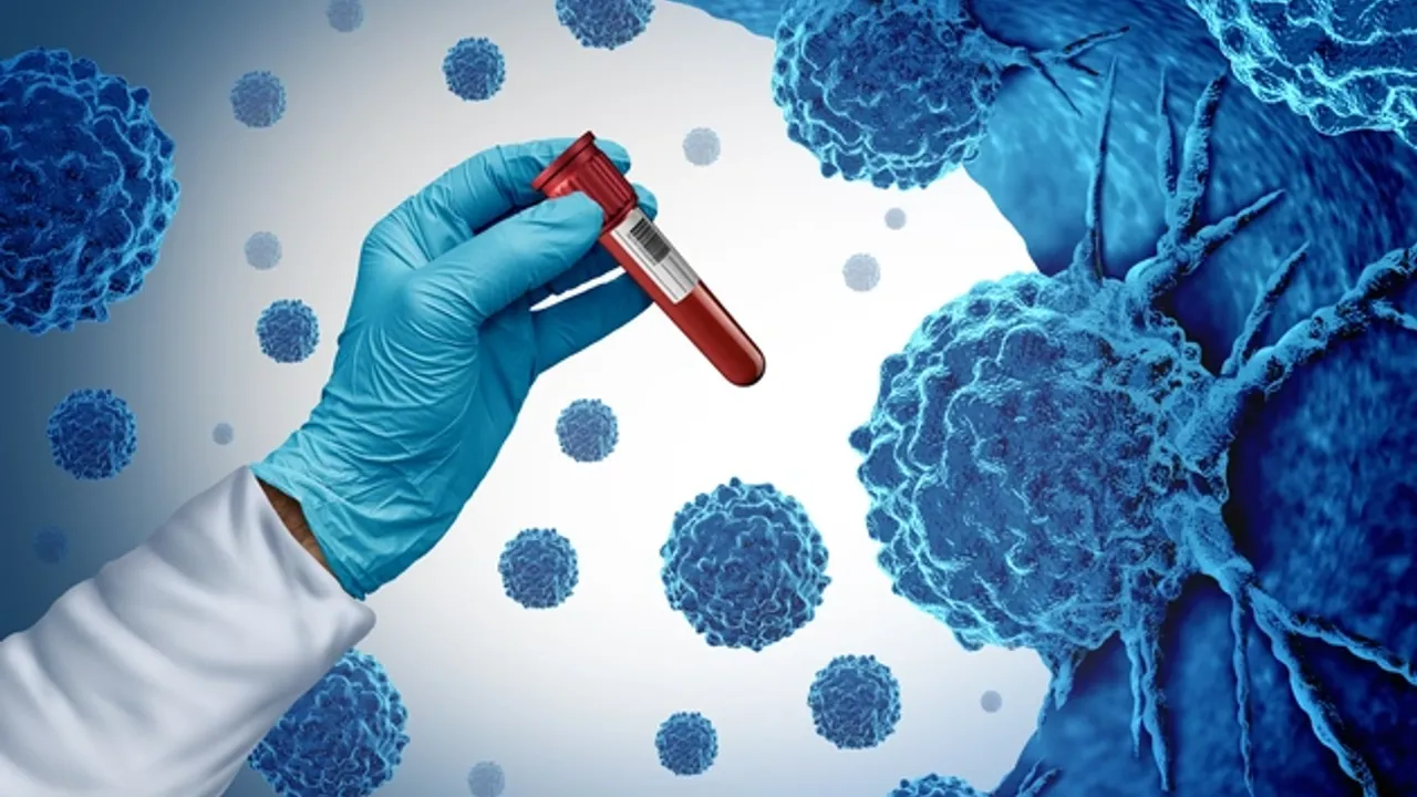 Kritik Rapor: Her Dört Kanser Vakasından Biri Aslında Engellenebilir