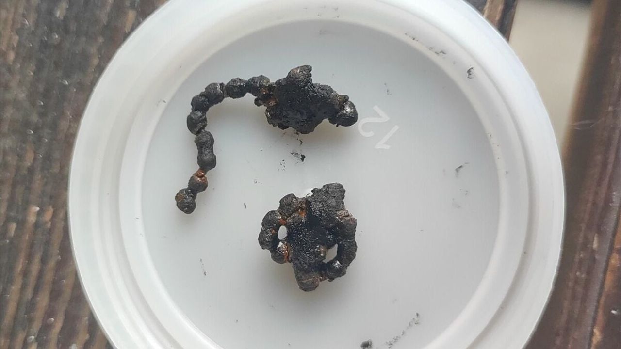 Görenler şok oldu: Operasyonla burnundan çıkarıldı!