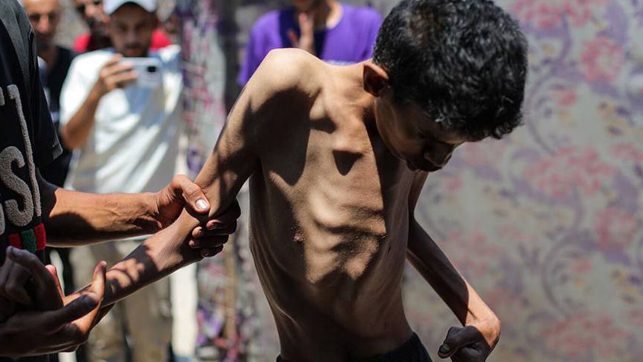 Gazze'de "Salgın hastalık" uyarısı