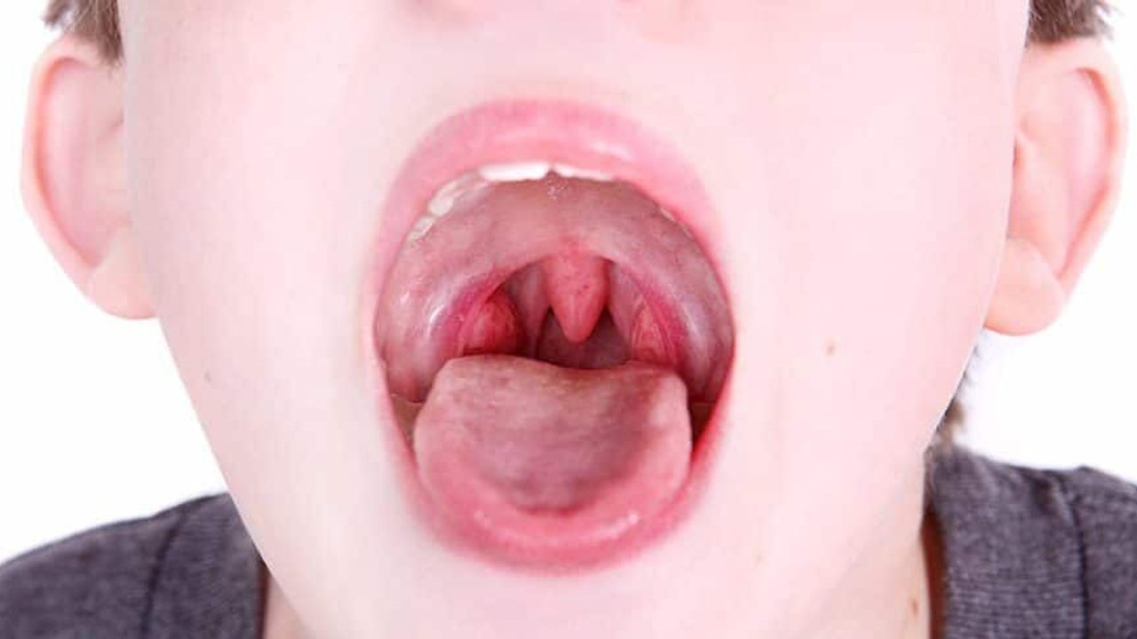 Geniz eti nelere sebep olur deme! Duyunca şaşıracağınız rahatsızlıklar...