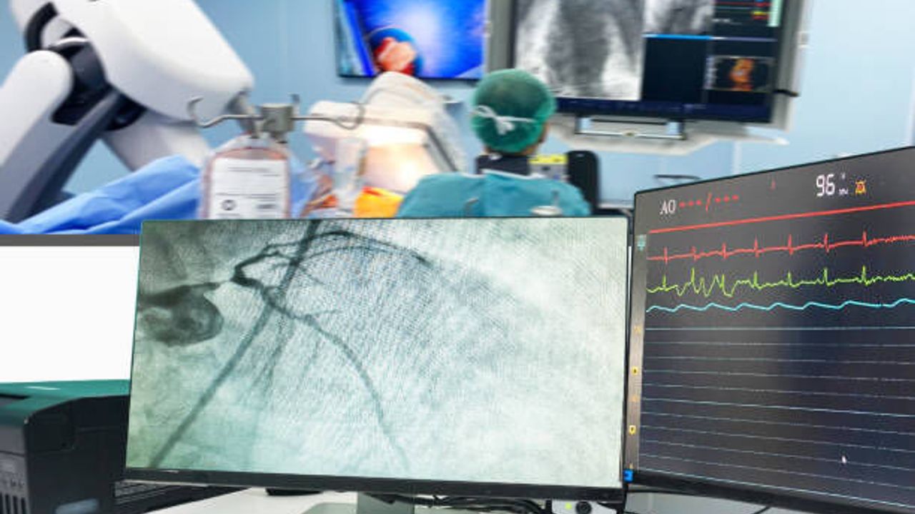 Anjiyo tam olarak nedir? Ne amaçla uygulanır? Anjiyo riskli bir işlem mi?