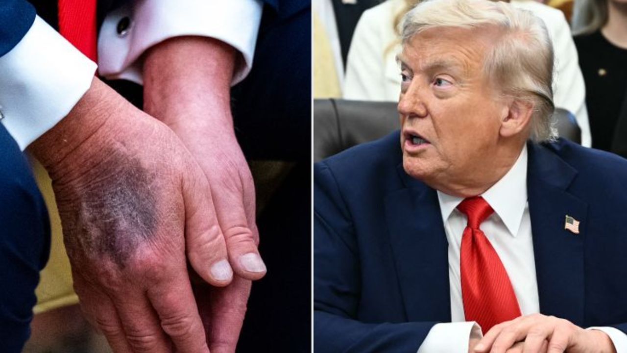 Trump hastaneye kaldırıldı iddiası