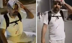 Bizim milletvekilimiz yaralandı ama Mısır'a ''dur'' çağrısı Yunan'dan geldi!