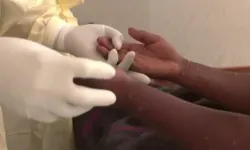 Madagaskar'da M çiçeği salgını yayılıyor: Vaka sayısı üç bini aştı