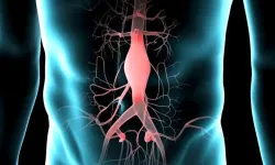 Sessiz ama tehlikeli bir hastalık: Aort anevrizması