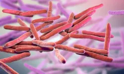 Avrupa cüzzam vakaları nedeniyle alarmda!