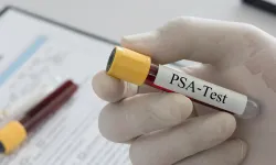 Prostat kanseri çoğu zaman belirti vermeden ilerler!