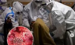 Asya'da Nipah virüsü alarmı!