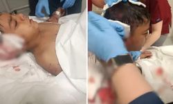 Ankara'nın göbeğinde köpek vahşeti: Çocuk tedavi altına alındı!