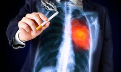 Sigara kullanımında zirve ülkeler netleşti! Türkiye'nin listedeki yüzdesi İŞTE BU!