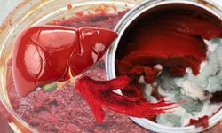 Mutfakta yapılan o hata karaciğeri bitiriyor!