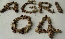 Ameliyata alınan hastadan 295 adet böbrek taşı çıkarıldı