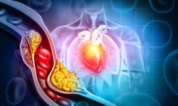 Kolesterol nedir? Kolesterol düşürücü doğal besinler neler?