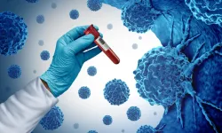 Kritik Rapor: Her Dört Kanser Vakasından Biri Aslında Engellenebilir