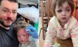 Yalova'daki saldırıya ilişkin son dakika: Bakanlık harekete geçti!