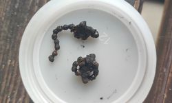 Görenler şok oldu: Operasyonla burnundan çıkarıldı!