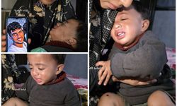 Siyonizm budur: israilliler 1 yaşındaki bebeğin bacaklarına çivi çaktılar