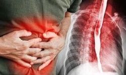 Gastrit neden olur? Gastrit tehlikeli mi? Gastrit olan kişi ne yememeli?