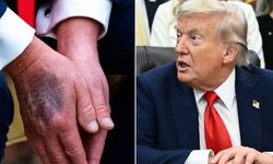 Trump hastaneye kaldırıldı iddiası