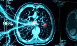 Kansere karşı algoritmik kalkan: Erken teşhiste görülmemiş isabet