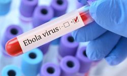 Ebola Virüsü Hakkında Bilmeniz Gerekenler: Nedir, Belirtileri Nelerdir?