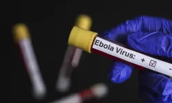 Fransa ilk Ebola vakasını açıkladı
