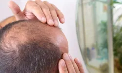 Çinliler buldu! Bu bitki kelliği bitirecek
