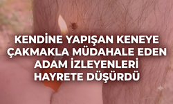 Kendine yapışan keneye çakmakla müdahale eden adam izleyenleri hayrete düşürdü
