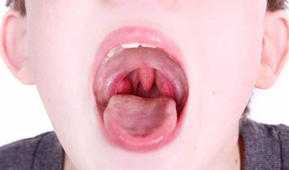 Geniz eti nelere sebep olur deme! Duyunca şaşıracağınız rahatsızlıklar...