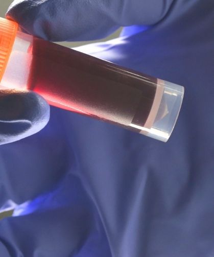 Kan grubunuz erken yaşta inme riskinizi etkiliyor