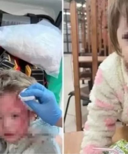 Yalova'daki saldırıya ilişkin son dakika: Bakanlık harekete geçti!