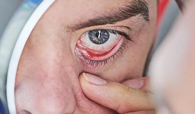 Diyabet göz sağlığını tehdit eder mi? Açıklama geldi