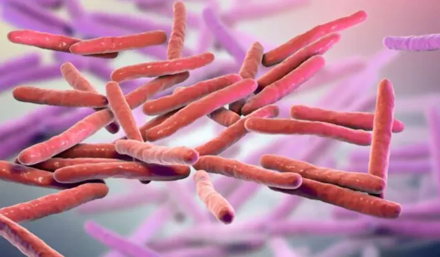 Avrupa cüzzam vakaları nedeniyle alarmda!