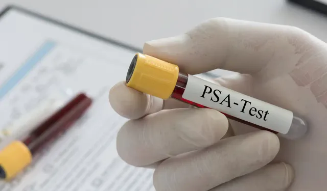 Prostat kanseri çoğu zaman belirti vermeden ilerler!