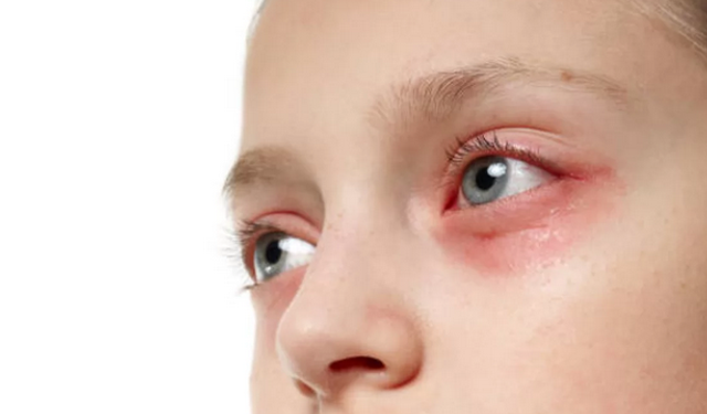 Op. Dr. Diri: Çocuklarda göz enfeksiyonları görme gelişimini olumsuz etkileyebilir