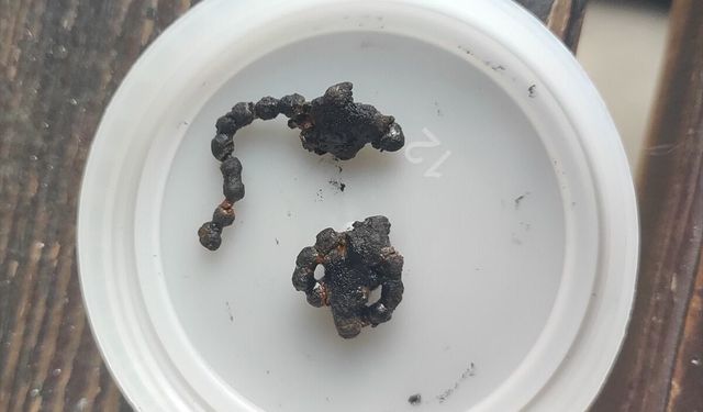 Görenler şok oldu: Operasyonla burnundan çıkarıldı!