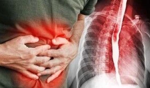 Gastrit neden olur? Gastrit tehlikeli mi? Gastrit olan kişi ne yememeli?