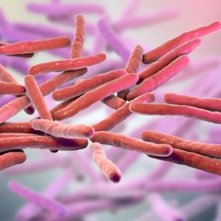 Avrupa cüzzam vakaları nedeniyle alarmda!