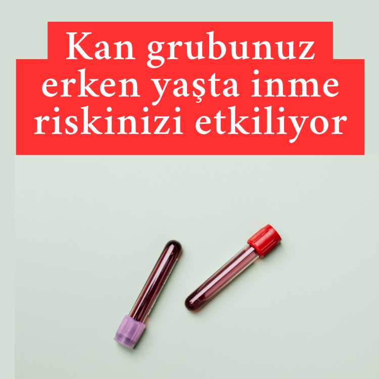 Kan grubunuz erken yaşta inme riskinizi etkiliyor: Hangileri riskli?