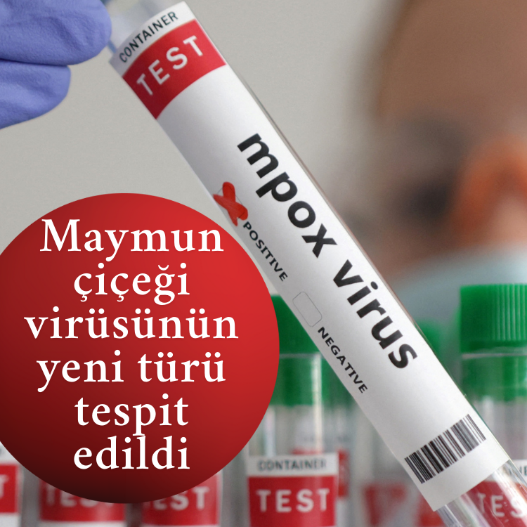 Maymun çiçeği virüsünün yeni türü tespit edildi