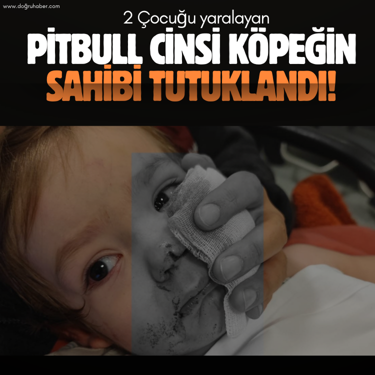 2 Çocuğu yaralayan pitbull cinsi köpeğin sahibi tutuklandı