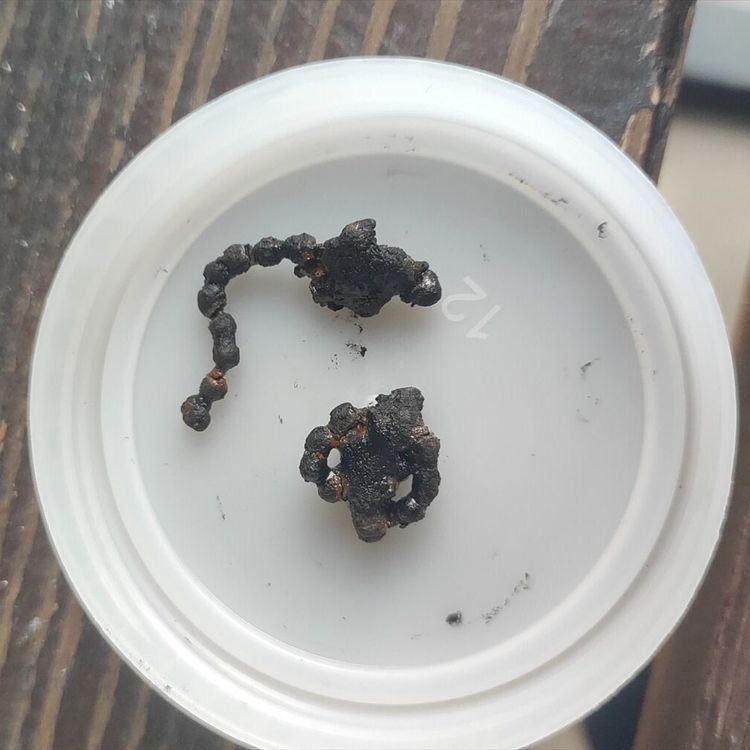 Görenler şok oldu: Operasyonla burnundan çıkarıldı!