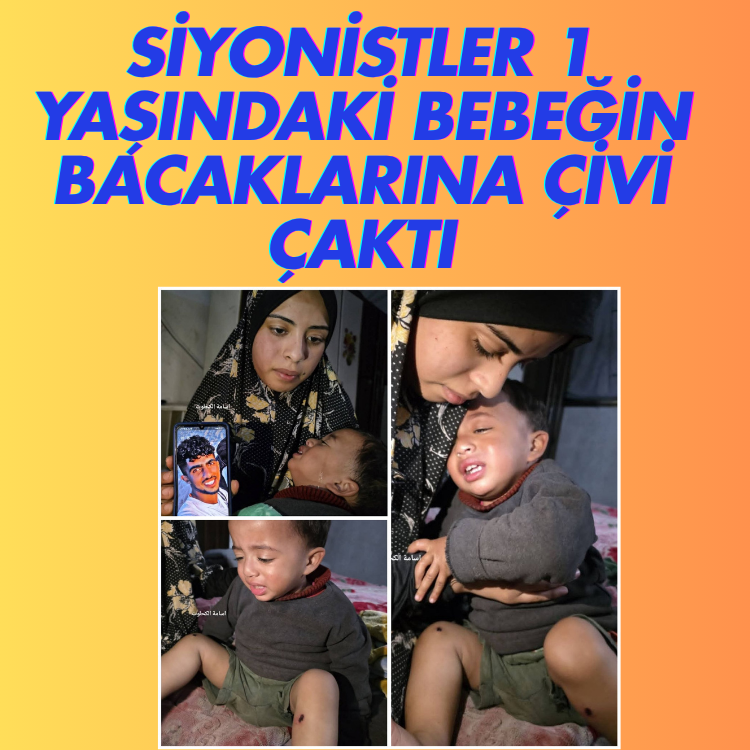Siyonizm budur: israilliler 1 yaşındaki bebeğin bacaklarına çivi çaktı