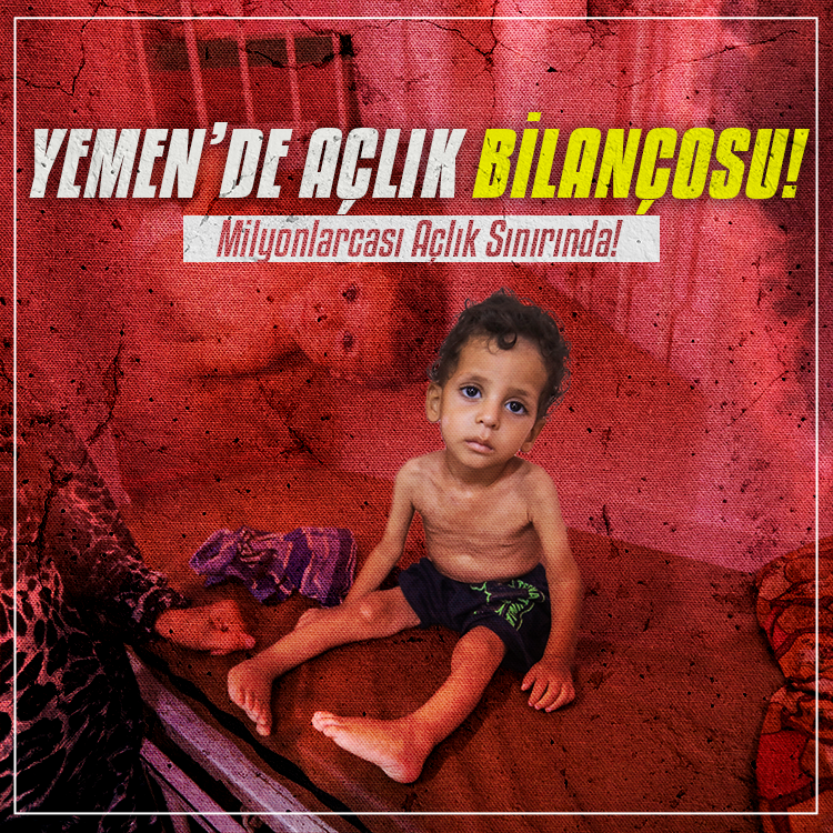 BM: Yemen'de yaklaşık 18 milyon insan açlık sınırında